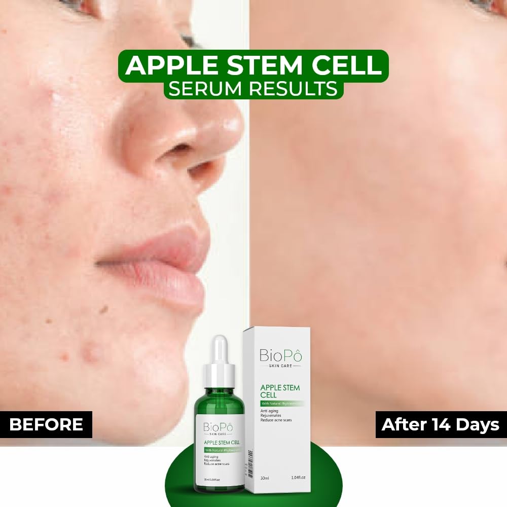 Apple Stem Cell Anti Aging Serum, Rejuvenates Skin, Reduces Acne Scars, Diminishes Fine Lines and Wrinkles, Hydrates Skin, For Radiant and Youthful Skin, 30 ml, Made in USA