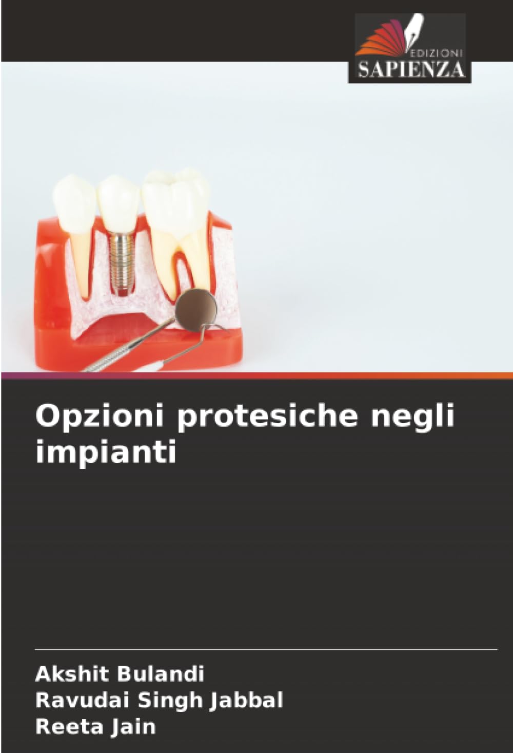Opzioni protesiche negli impianti