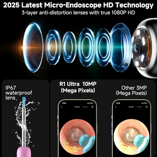 Image of BEBIRD R1 Ultra Ear Wax Removal, Ear Cleaner with Camera Ear Scope, Wax Remove Ear Pick with Ear Otoscope Tweezers, Visual Dropper Cleaning Kit, Ear /Nose /Throat Examination Tool for Family, Pink