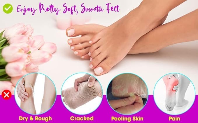 Heel Pain Relief Silicone Gel Heel Socks Foot Protector Anti Crack Heel Socks Heel Protector Socks Silicon Toe Free Heel Pain Relief Socks for Men and Women
