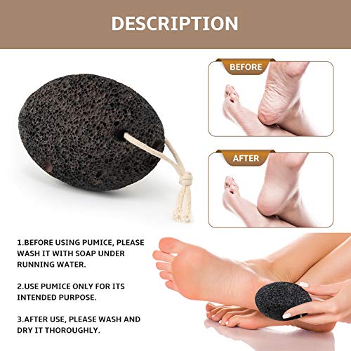 Chrider Foot File Callus Remover Foot Scrubber & Pumice Stone Set, Professional Wood Pedicure Foot File, Foot Care Pedicure to Remove Hard Skin and Corn, Can be Used on Both Wet and Dry Feet, 2 Packs