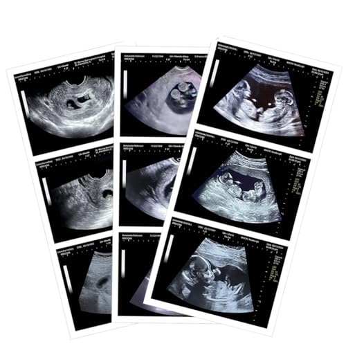 Personalized Fake Ultrasound | Realistic Fake Pregnancy Ultrasound |...