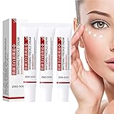3PCS Spot Off Freckle Whitening Cream, Freckle Remover Cream, Acne Scar Removal Treatment Cream,...