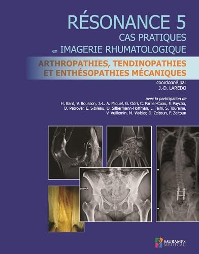 Résonance: Cas Pratiques En Imagerie Rhumatologique; Arthropathies, Tendinopathies Et Enthésopathies Mecaniques (5) (French Edition)