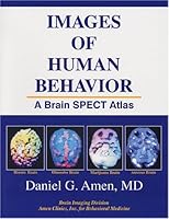 Images of Human Behavior: A Brain SPECT Atlas 1886554048 Book Cover