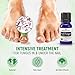 Forces of Nature Toenail Nail Fungus Treatment, Organic Antifungal Restores Appearance of Toenails and Fingernails, Homeopathic Medicine for Cracked, Dry, Damaged & Discolored Nails, .37 fl oz