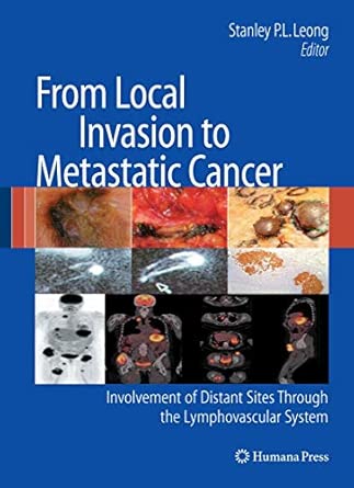 From Local Invasion to Metastatic Cancer: Involvement of Distant Sites Through the Lymphovascular System 2009th Edition book cover