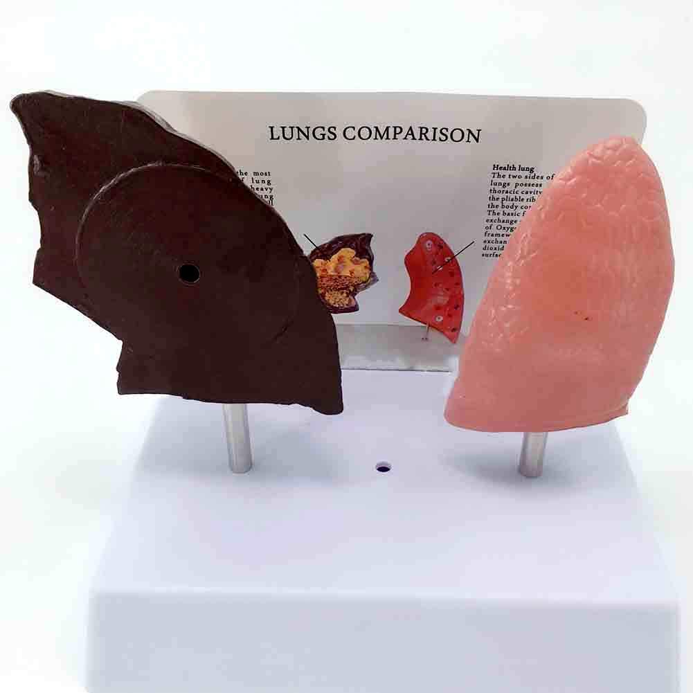 Anatomía Modelo anatómico Ensamblaje Anatómico Los pulmones Pulmón Patología Normal Modelo anatómico Aula para la educación del Paciente para la Escuela,Educación
