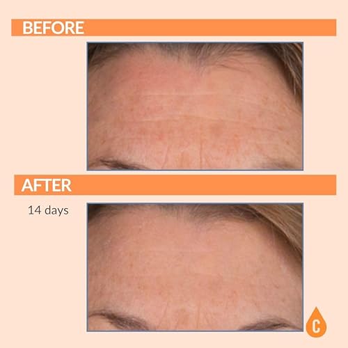 Miniatura 4 de Serious Skincare Serious C3 Plasma C Cream Vitamina C Ester Protector Diurna Amplio Espectro SPF 30 Hidratante  2 oz  Crema hidratante facial