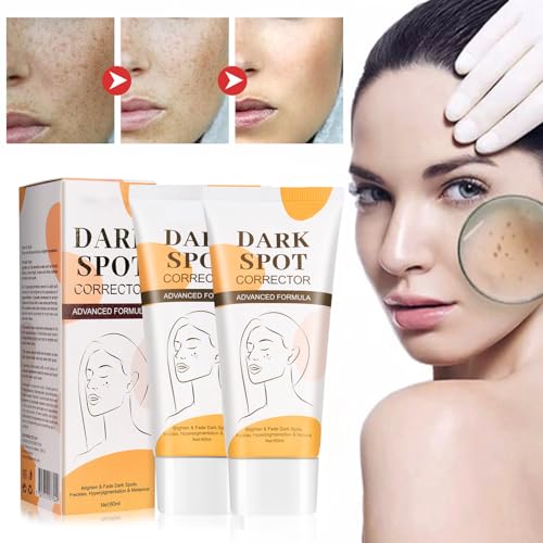 Tkekruh 2PC Crema Blanqueadora de Manchas 60ml, Crema Hidratante Aclarante y Anti Manchas, Crema Antimanchas Facial, Blemish Cream, Anti Manchas Regeneradora y Aclarante, Reduziert Dunkle