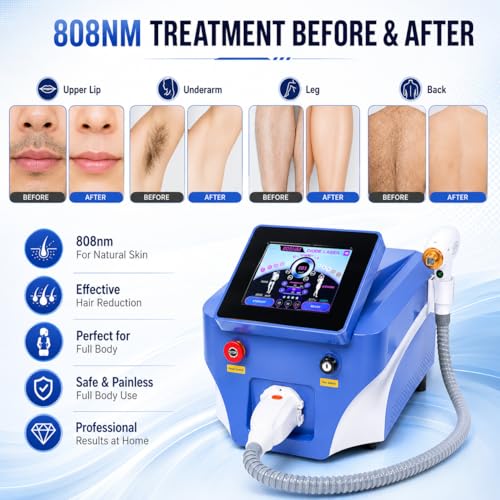 Macchina professionale di depilazione del laser a diodi a lunghezza d'onda, raffreddamento a zaffiro freddo 100J/cm2, riduzione permanente dei capelli del corpo per uso domestico, 755/808/1064nm per t