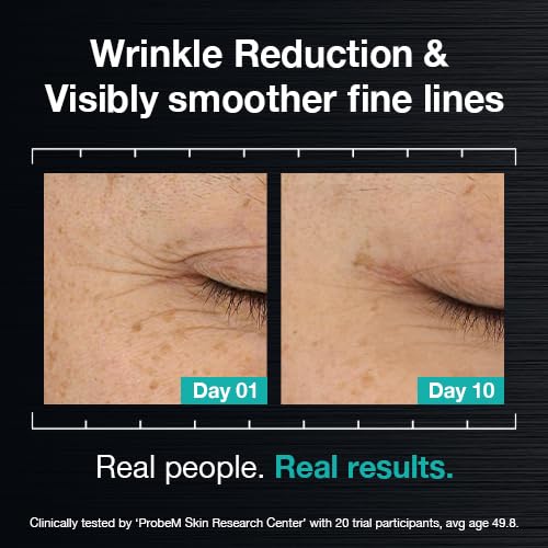 Advanced Wrinkle Repair Peptide Serum, Firming & Fine Line Smoothing, Fragrance-Free, 30 mL (Powered by PDRN 5% + Exosomes + Matrixyl® 3000 Peptides)
