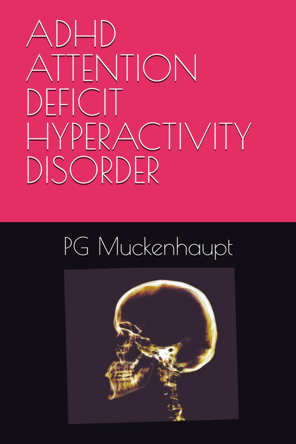 ADHD ATTENTION DEFICIT HYPERACTIVITY DISORDER