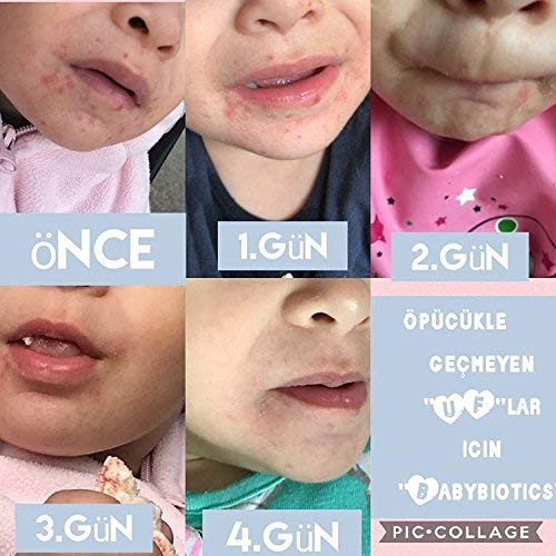 Babybiotics - Topical Probiotic Body Care For Children Of All Ages 4Oz -Hypoallergenic, Vegan, Non Gmo, Gf, 100% Natural Live Probiotic Patented, External + Internal Use,Totally Safe, No Refrigeration #TOP3