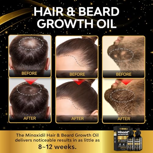 Image of 5% Minoxidil Hair Growth Serum for Men & Women, Beard Growth Oil 2oz 4pcs