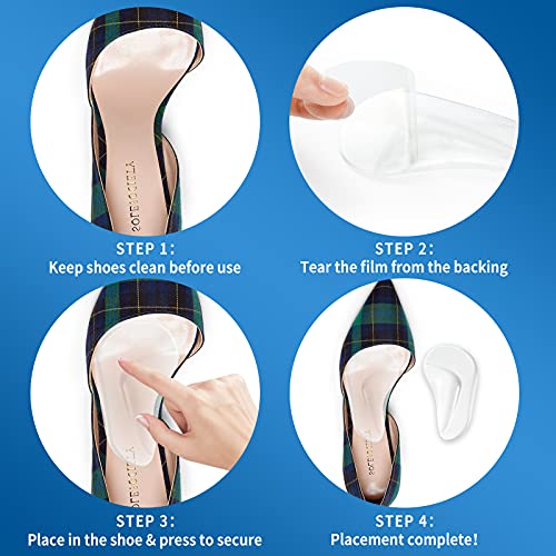 Orthopedic Insoles For Men And Women, Height Increase Silicone Shoe Pad For Corrective Pronation, Shoe Cushions For Foot Alignment, Knock Knee Pain, Bow Legs (S) #TOP5