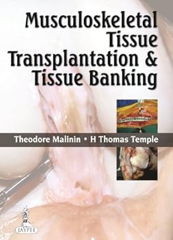Hardcover Musculoskeletal Tissue Transplantation and Tissue Banking Book