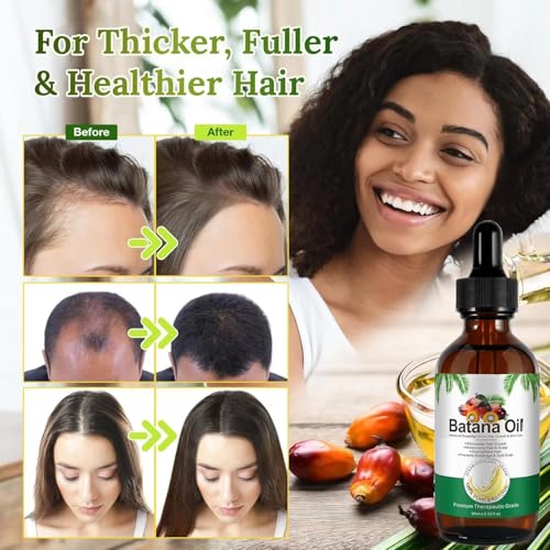 Batana-Oil-for-Hair-Growth-Hair-Treatment-Serum-CapsulesRaw-Batana-Hair-OilNo-Rinse-Hair-Vitamin-Serum-for-Dry-Damaged-HairHair-Treatment-Leave-in-Anti-Frizz-Conditioner-Vitamins-A-E-Pro-B5