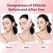 V Line Face Lifting Strap, Chin Strap for Sleeping, Double Chin Reducer for Women, Jaw Line Sculptor Eliminator, Mask Shaper for Jawline, Neck Lift Jaw Tightening Exerciser, Face Lift Tape Remover