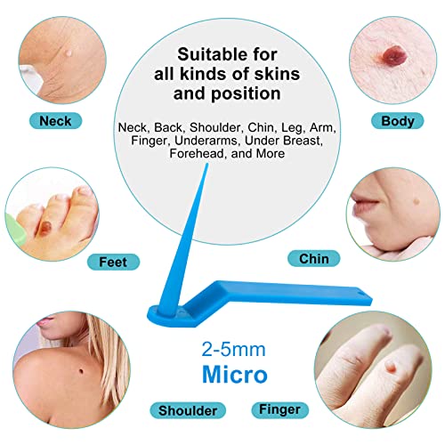 116 Stck Skin Tag Removal Patch Kit, Stielwarzen Entfernen schnell Entfernen Schnell Kit fr Gesicht, Hals und Krper - Image 6