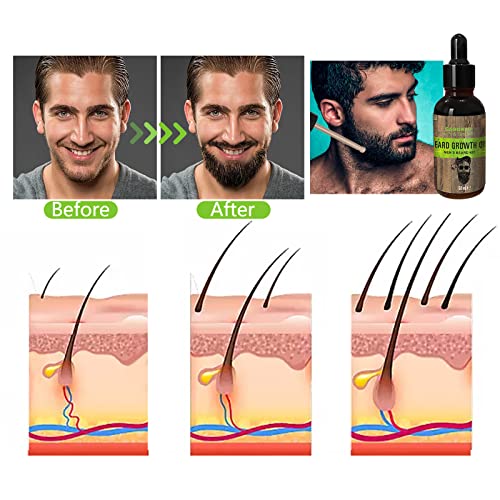 Caqorzo Beard Growth Kit, Beard Kit, Beard Grooming Kit W/Beard Oil, Beard Wash, Beard Roller, Beard Balm (Growth Kit) #TOP2