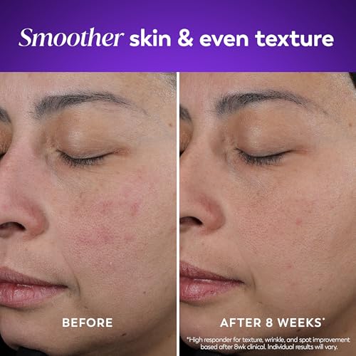 Olay Retinol Night Cream for Women, Anti-Aging Face Moisturizer, Fragrance-Free, Non Greasy - Anti-Wrinkle, Smooth Fine Lines, Hydrating Skin Care - Triple Collagen Cream, Peptide, Niacinamide, 1.7oz - Image 4