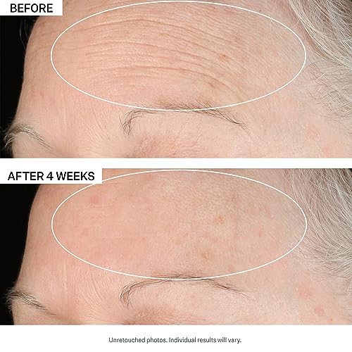 Anti-Wrinkle 2 Piece Kit, Peptide Plump Serum for Face 1 oz & SD Advanced Moisturizing Cream for Wrinkles 2 oz - Image 4