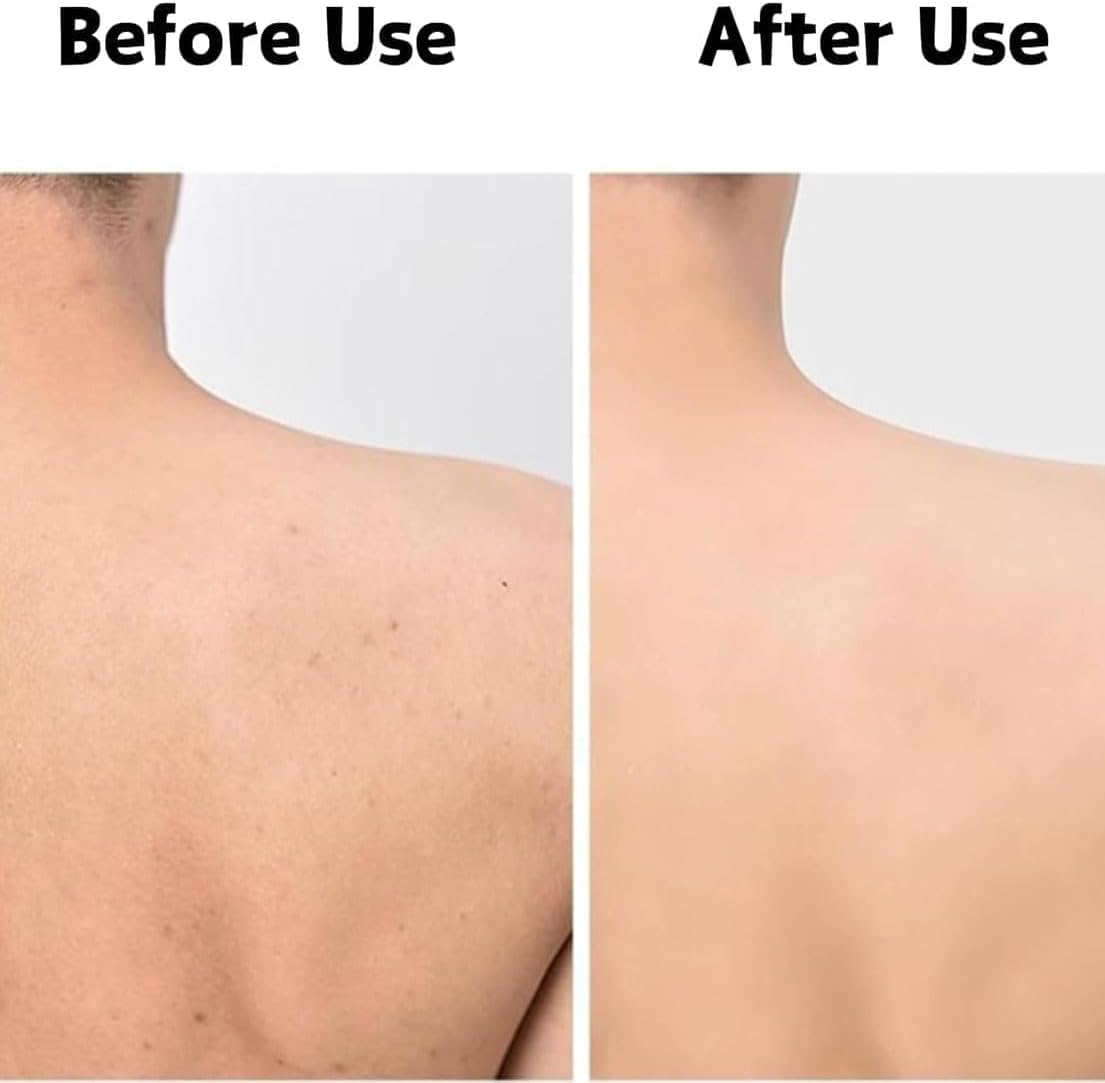 Exfoliating Shower Towel, Exfoliating Antibacterial Shower Towel, For Use in Shower Bath, Exfoliate Rags Wash Cloths, Loofah Lufa Sponge, Body Scrub, Women Men (2pcs Grid Black) - Image 4