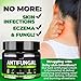 Natural Antifungal Cream - Made in USA - Effective Treatment for Toenail Fungus, Athletes Foot, Ringworm Treatment for Humans, Jock Itch - Combats Body Acne - Aloe Vera, Tea Tree, Mineral Oils - 2 OZ