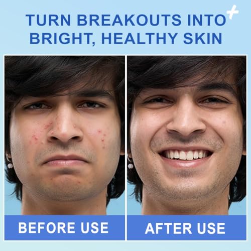 Image of HEY TEEN Acne Face Wash for Teens & Kids 9+ Years | Foaming Cleanser for Boys & Girls | Helps Reduce Pimples, Acne & Excess Oil | with Niacinamide, Neem & Zinc PCA | Daily Face Wash for Oily Skin