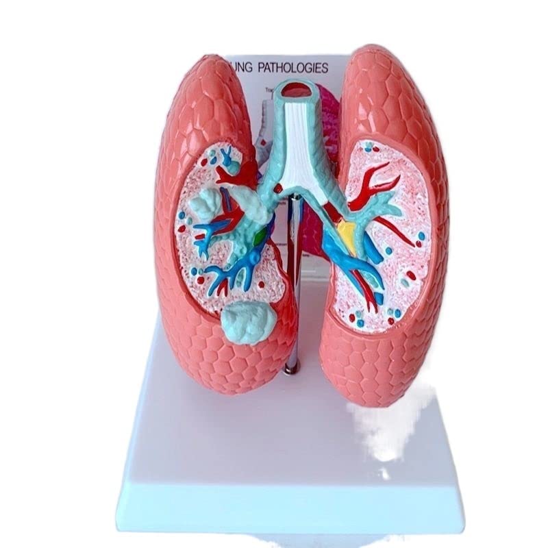 Buy Liseal Human Respiratory System y Lung Anatomy Teaching Model Lung ...
