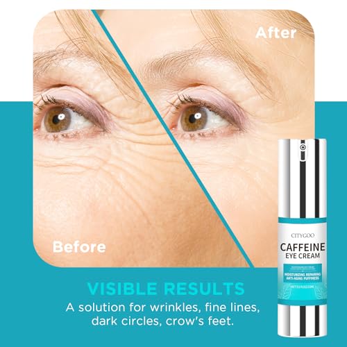 Citygoo 0929210 Snail Eye Stick For Dark Circles: Anti Wrinkle Snail Cream Eye Puffiness Treatment thumb #3