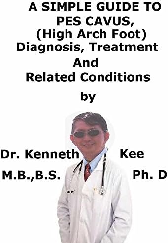 A Simple Guide To Pes Cavus, (High Arch Foot) Diagnosis, Treatment And Related Conditions (A Simple Guide to Medical Conditions) Kindle Edition