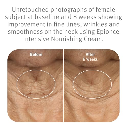 Epionce Intensive Nourishing Cream, view 4