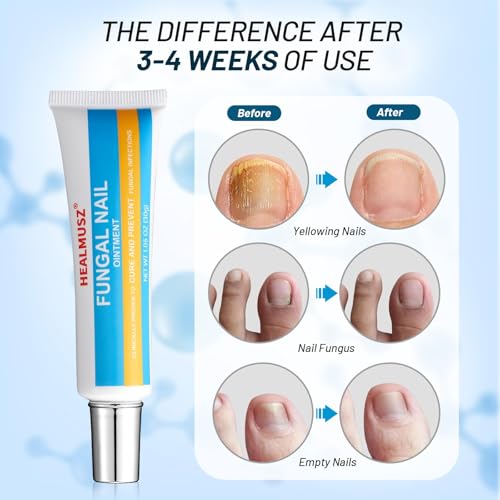 Image of Toenail Fungus Treatment Extra Strength, AntiFungal Ointment for Ingrown, Yellow, Discolored and Damaged Nails, Gentle & Effective.