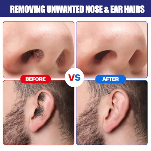 Image of Nose Wax Kit, 30 Applicators,Nostril and Ears Hair Removal Kit for Men & Women,Includes 15 Balm Wipes and Mustache Guards etc. Lasts up to 6 Weeks (120g)