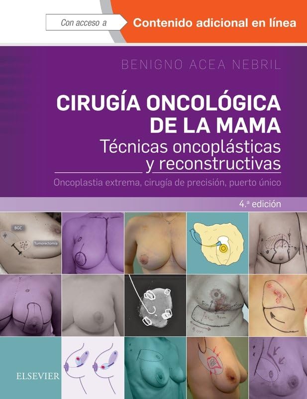 Cirugía oncológica de la mama - 4ª edición