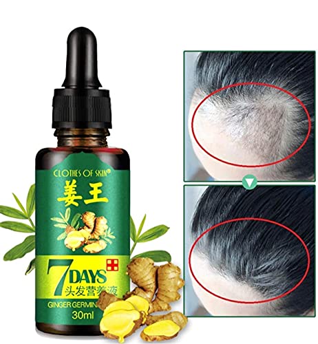 7 Day Ginger Germinal Serum Essence Oil Loss Treatment Growth Hair,Ginger Germinal Oil, Ginger Hair Growth Serum, Ginger Essential Oil (1 Pack) #TOP1