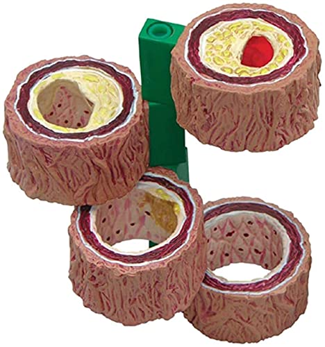 DYTAH Modello Arterioso Aterosclerosi Modello Cardiovascolare Medicina Interna Strumento di Aiuto Educativo Medico, Modelli Medici E Materiali Educativi per La Dimostrazione Medica