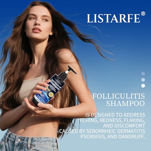 Dandruff Shampoo, Anti-Fungal Shampoo for Psoriasis & Seborrheic Dermatitis – Scalp Treatment for Itching, Flaking & Redness Relief for Men and Women, 300ML (Peppermint)