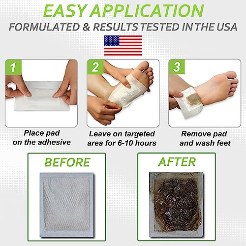 Dr. Entre's Premium All-Natural Aromatherapy Foot Pads+Adhesive Sheets - Pain Relief - Sleep Aid - Cleanse - FDA Certified - Utmost Foot Care - 2017 New(10)