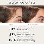 OUAI Scalp Serum - Balancing Hair Serum with Red Clover Extract, Siberian Ginseng and Peptides for Thicker and Fuller-Looking Hair - Paraben, Phthalate and Sulfate Free Scalp Care (2 Fl Oz) - Image 5