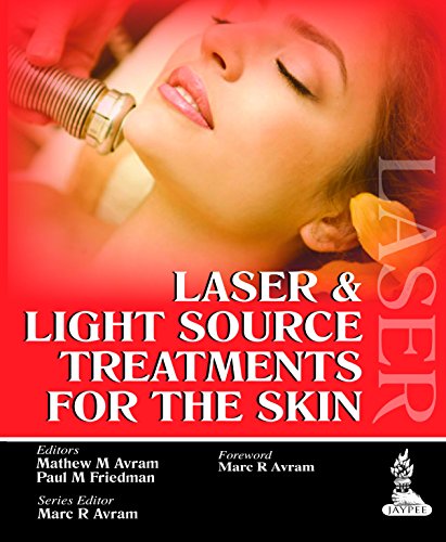 Laser  Light Source Treatments for the Skin (English Edition)