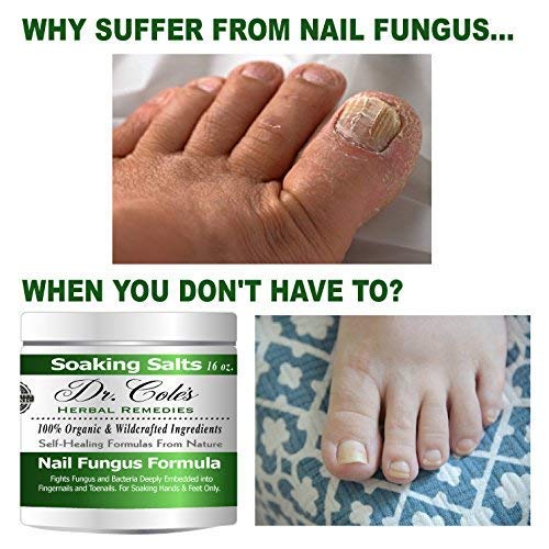 Dr. Cole's Organic AntiFungal Hand & Foot Soaking Salts Extra Strength, Herbal, AntiFungus