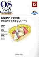 股関節の骨切り術−関節温存手術のポイントとコツ [DVD付] (OS
