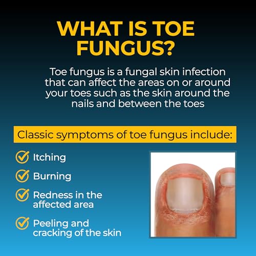 image for Fungi-Nail Anti-Fungal Foot Spray, Kills Fungus That Can Lead to Nail 