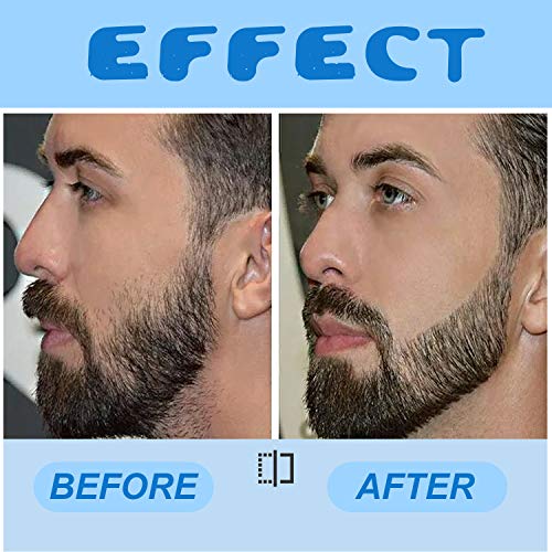 LATTCURE Bartwachstumsroller, Dermaroller 0,5 mm, MicroneedlingRoller, Beard Rolleraus für Bartpflege, Die Ihnen einen… - Image 7