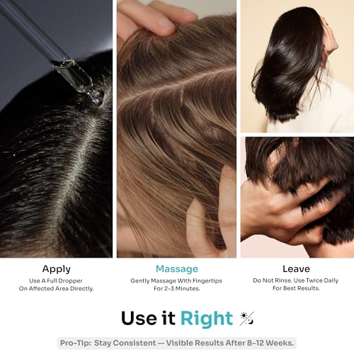 Image of Kitcoz Hair Growth Serum, 21% Actives, Redensyl, Procapil & Anagain, 30ml | Clinically backed ingredients that reduces hair fall and support stronger, thicker, fuller-looking hair