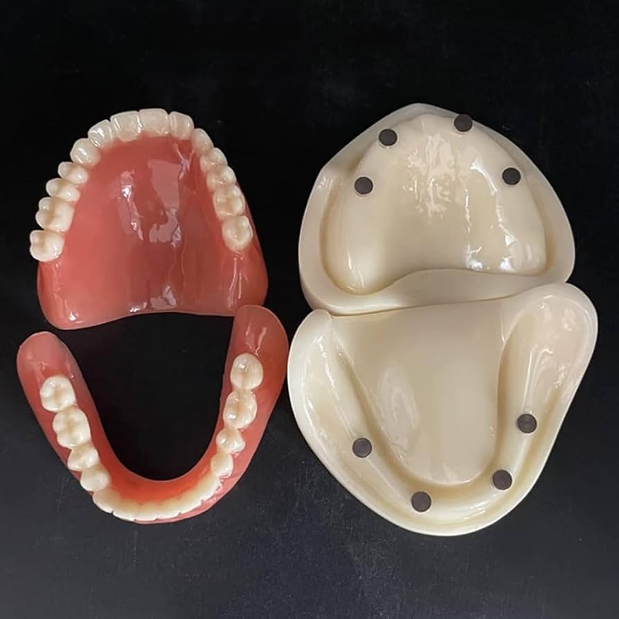 Amazon.co.jp: 「NexPon」歯列模型 歯科インプラントモデル