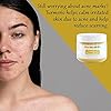 Turmeric-Face-Mask-for-Sensitive-Skin-Deep-Pore-Cleansing-Mask-Skin-Moisturizing-Face-Mask-Organic-Face-Mask-Skin-Care-with-Manuka-Honey-Kaolin-Clay-and-Bentonite-Clay-Mask-3oz Turmeric Face Mask Acne Scars and Dark Spot Remover - Deep Pore Minimizer and Anti Aging Face Mask - Skin Moisturizing Face Mask - Face Moisturizer for Glowing Skin and Pimple Spot Treatment (3oz)